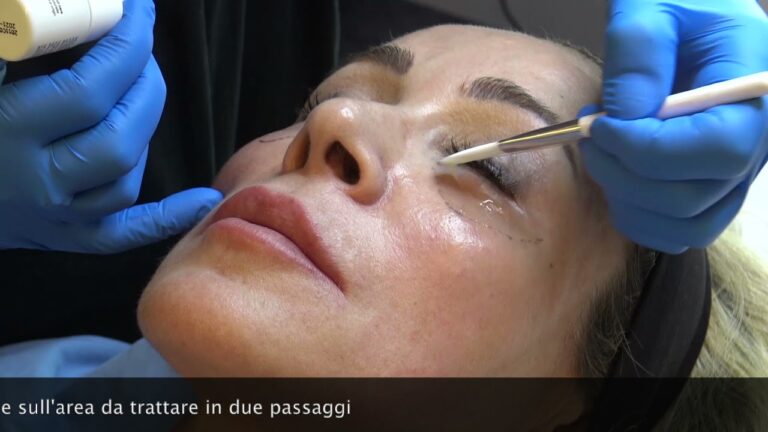 Benefici della Crema con Ialuronidasi per la Pelle