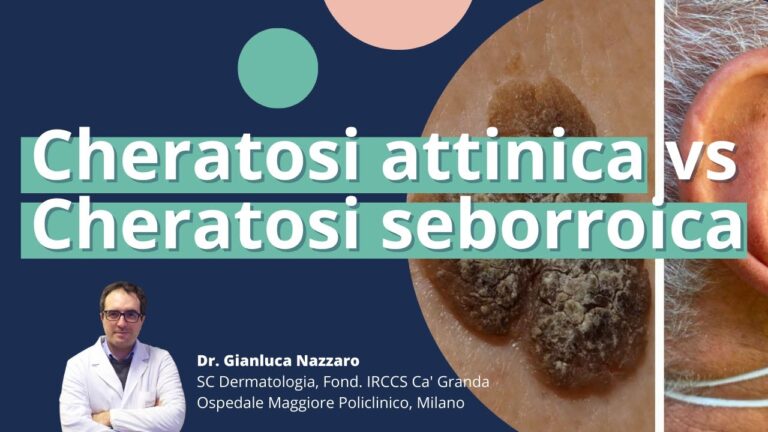 Gestione Efficace della Pelle Ipercheratosica