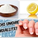 Neurinoma della Gamba: Diagnosi e Trattamento Efficace