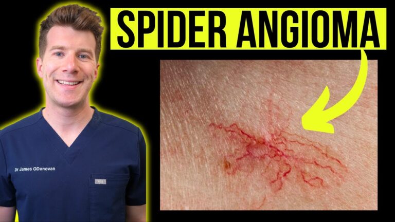 Scopri il Mondo di Spider Nevo: Innovazione e Design