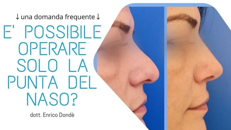 Correzione Punta Naso: Costi e Opzioni Disponibili