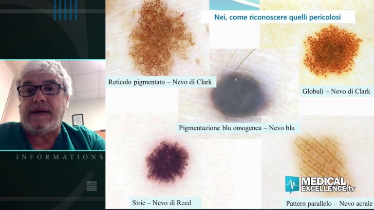 Il Fascino del Neo con Puntino Nero al Centro