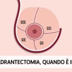 Calorie delle Nocciole: Valore Nutrizionale per 100 Grammi