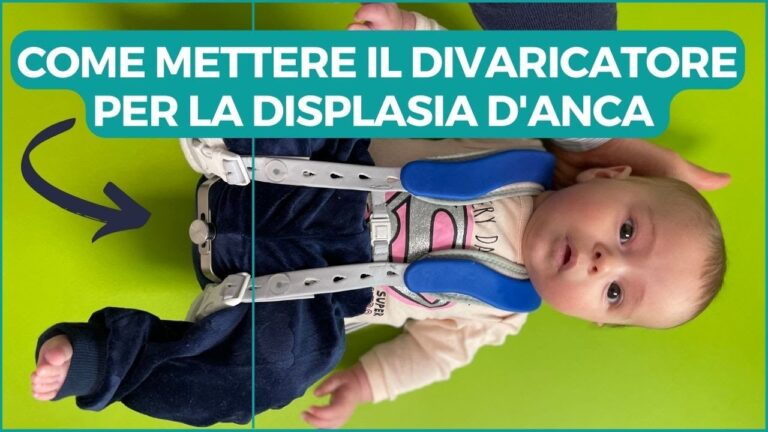 Guida all’Utilizzo del Divaricatore per Neonati