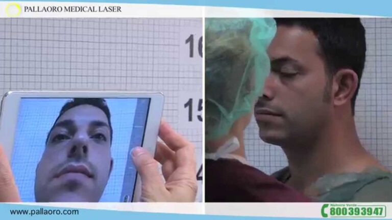 Naso Rifatto per Uomini: Guida e Aspettative