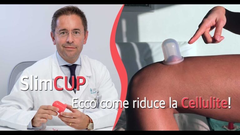 Cellulite: Perch&eacute; Peggiora Dopo il Massaggio