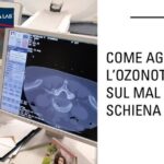 Ottimizzazione dei Costi per le Radiografie Toraciche