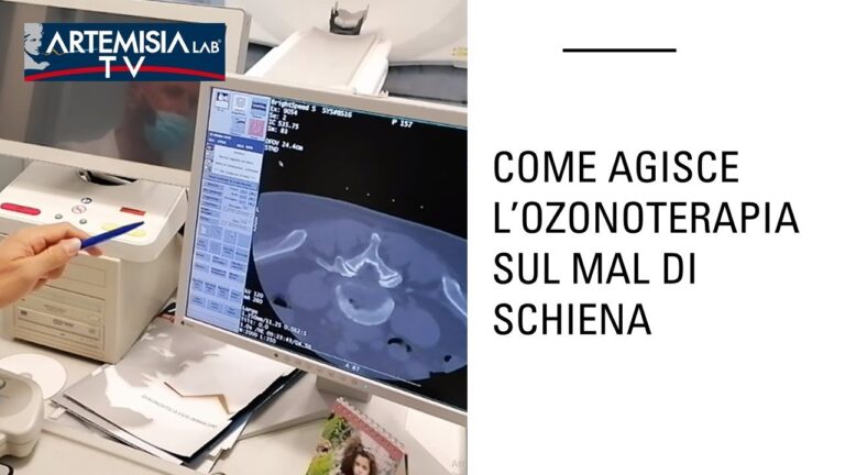Infiltrazioni di Ozono per il Trattamento del Mal di Schiena
