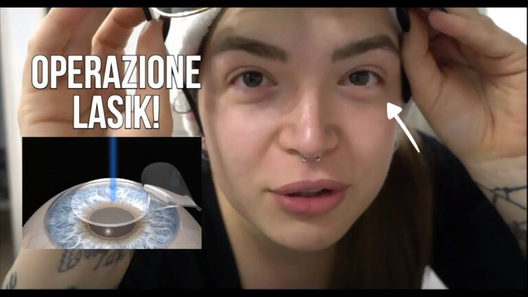 Esperienze Negative con il LASIK: Cosa Sapere