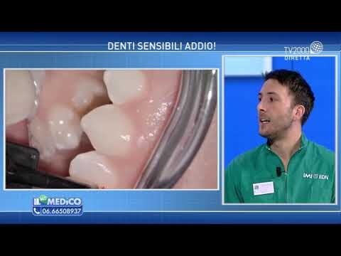 Rimedi Efficaci per la Sensibilità dei Denti