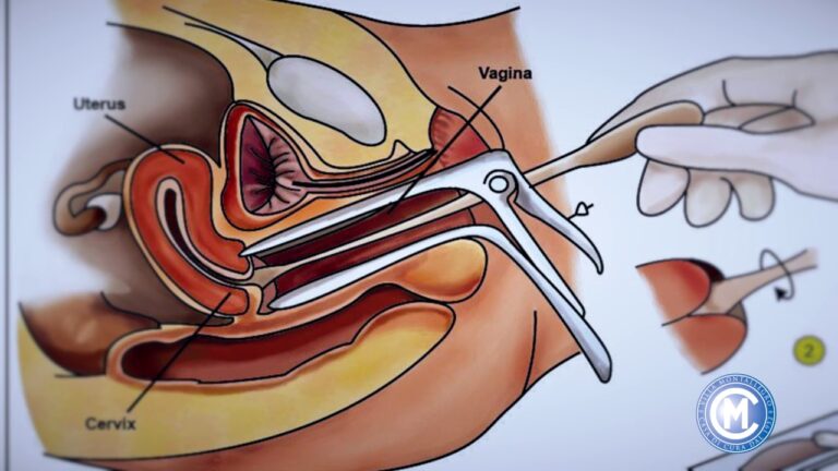 Pap Test per Uomini: Importanza e Informazioni Essenziali