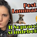 Ruolo dell’anticorpo anti-citrullina nella patologia