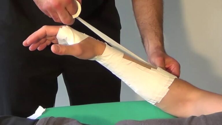 Trattamento Efficace della Tendinite al Polso con Fasciatura