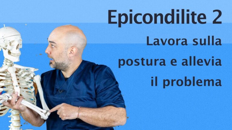 Epicondilite e Cervicale: Cause, Sintomi e Trattamenti