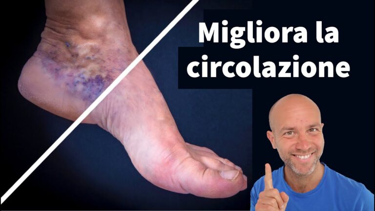 Crema per Migliorare la Circolazione delle Gambe