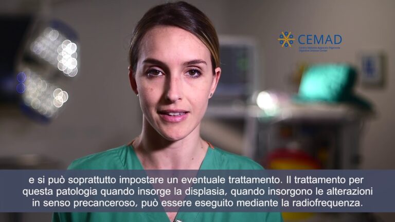 Testimonianze sull’Esofago di Barrett: Esperienze e Riflessioni