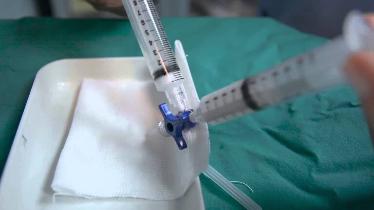 Camminare dopo il trattamento con sclerosanti: consigli e benefici