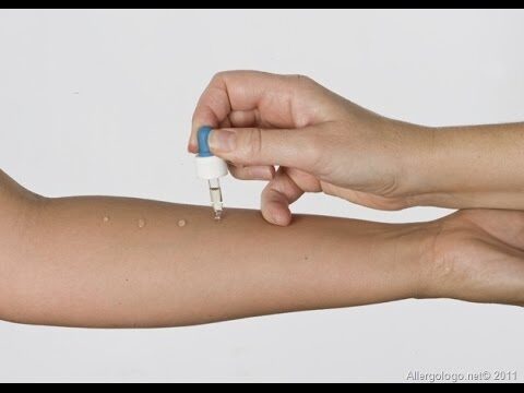 Costo delle prove allergiche: tutto ciò che devi sapere