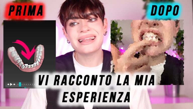 La Trasformazione di Dr. Smile: Prima e Dopo