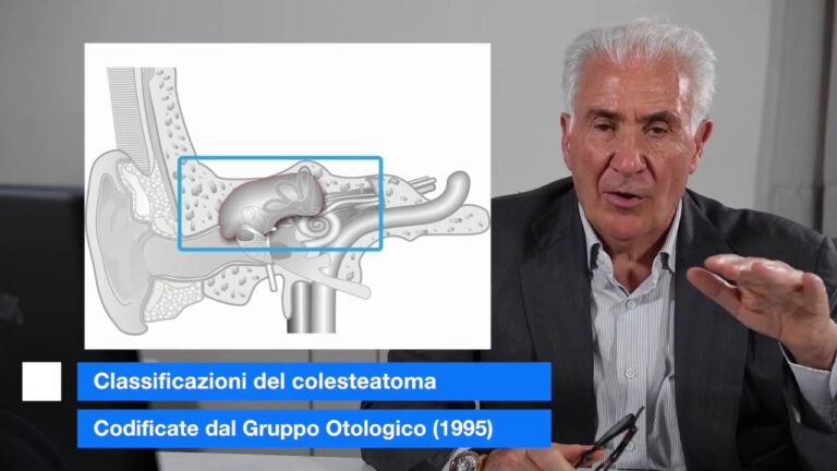 Sintomi dell’Infiammazione della Rocca Petrosa