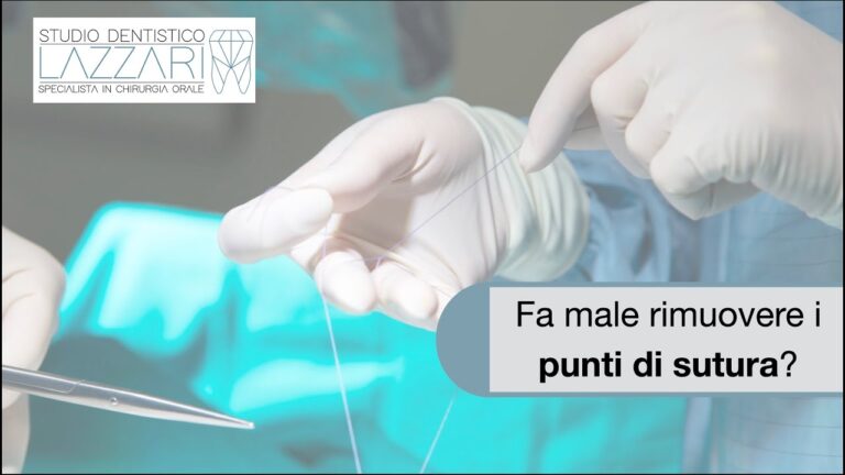 Punti Riassorbibili: Tempi di Caduta e Vantaggi