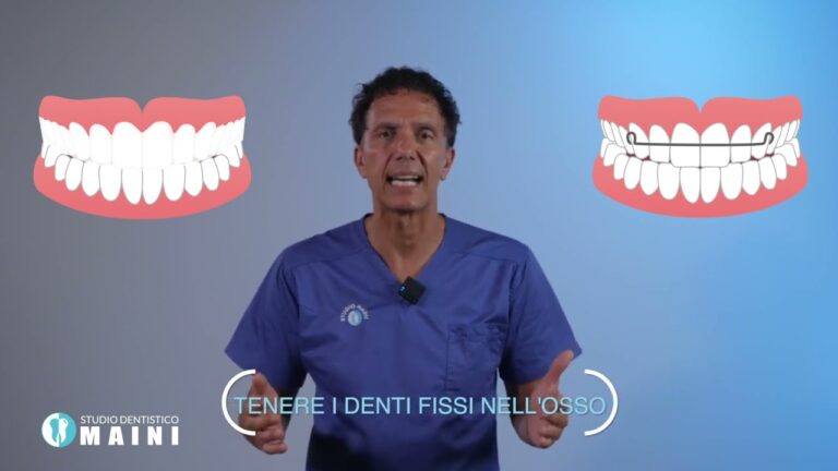 Contenzione Denti: Soluzioni per una Vita Sorridente