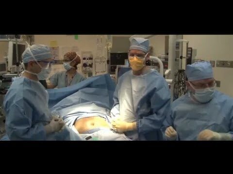 Sleeve Gastrectomy: Vantaggi e Considerazioni Essenziali